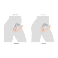 XR Brands Strap U - World's 1st Remote Control Inflatable Ergo-Fit Strapless Strap-On -Cal Exotics Shop ebh5gkjebribhg7zgrdw